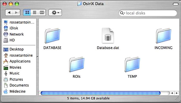 OsiriX ローカルデータベース管理2