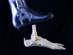File:Artificial ankle.jpg
