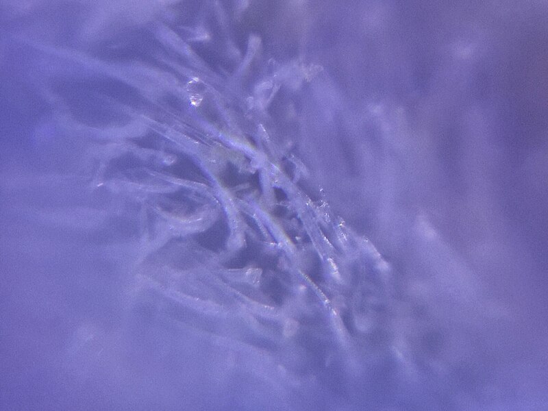 Lêer:Cannabis Trichomes as seen under DIY macroscope4.jpeg