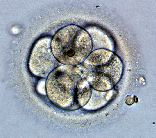 Эмбрион человека на 3 сутки развития, состоит из 8 бластомеров. Автор: NinaSes. Вклад автора (серия фотографий).