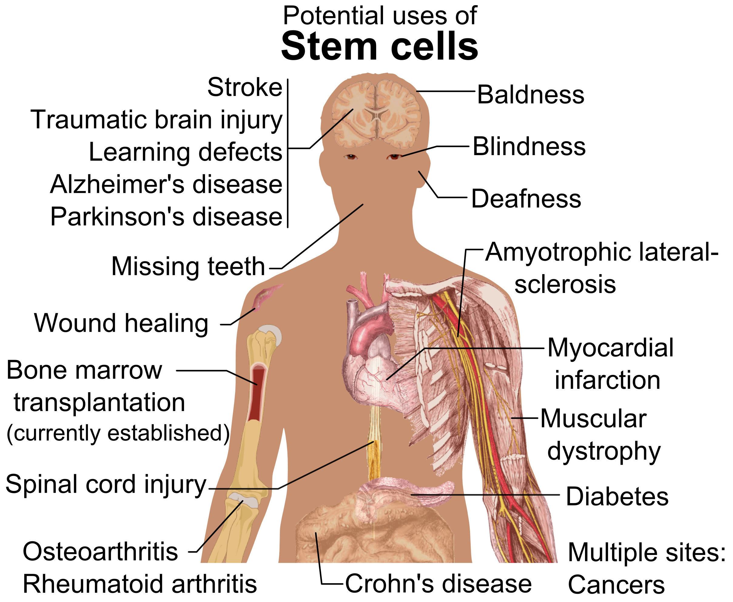 Stem cell treatments