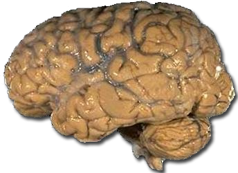 Human brain NIH