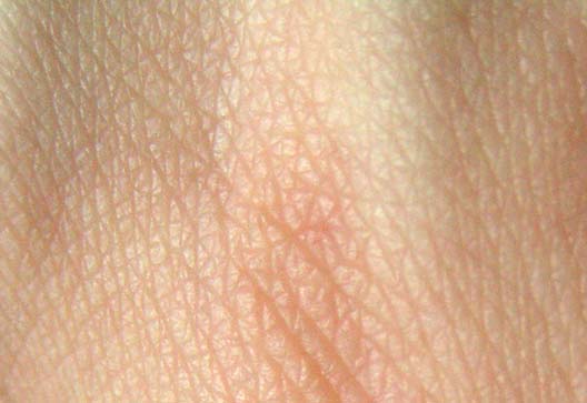 Human_skin_structure.jpg