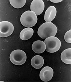 Red blood cells (erythrocytes) are one of the ...