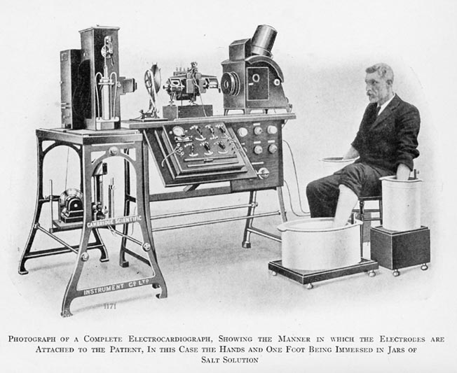 String Galvanometer