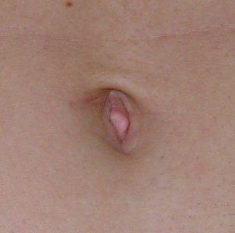 Belly-button.jpg