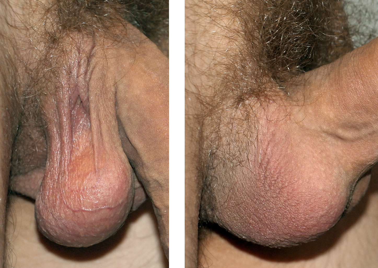 Genitals male shaved