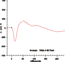 Electroretinogram waveform from a dark-adapted...