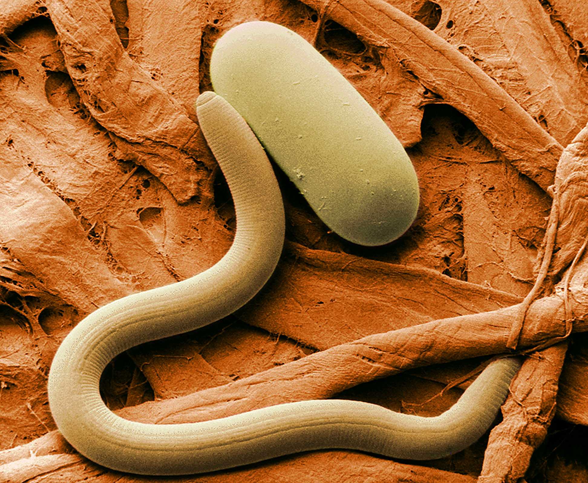 File:Soybean cyst nematode and egg SEM.jpg - Wikipedia, the free