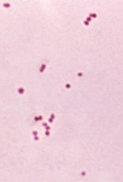 Neisseria meningitidis -bakteeri mikroskoopissa