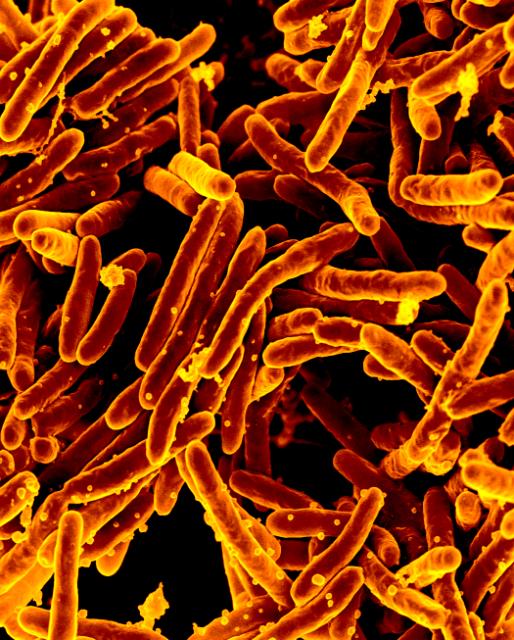 Mycobacterium tuberculosis Bacteria, the Cause of TB Scanning electron micrograph of Mycobacterium tuberculosis bacteria, which cause TB. Credit: NIAID