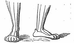 German bear-claw shoe, 1800s illustration