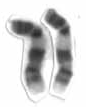 Lidský mužský karyotp s vysokým rozlišením - chromozom 9 oříznut.png