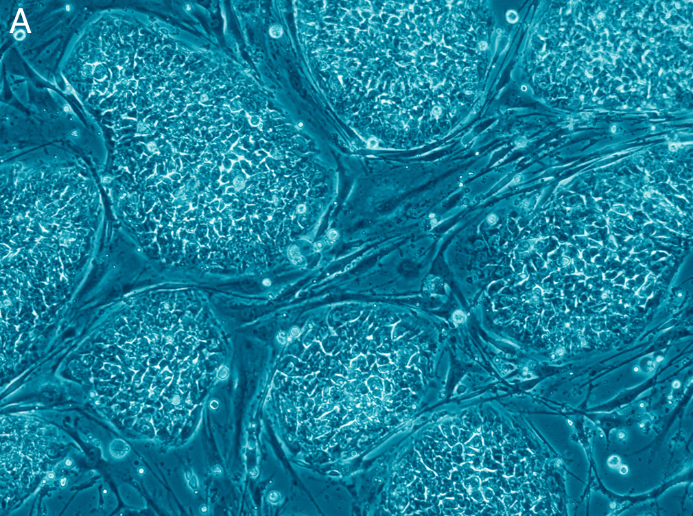 Human Embryonic Stem Cells (Nissim Benvenisty, via Wikimedia Commons)