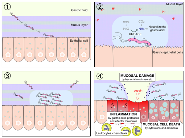 File:H pylori ulcer diagram en.png