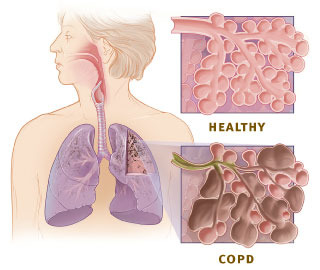 Healthy Lung Pictures