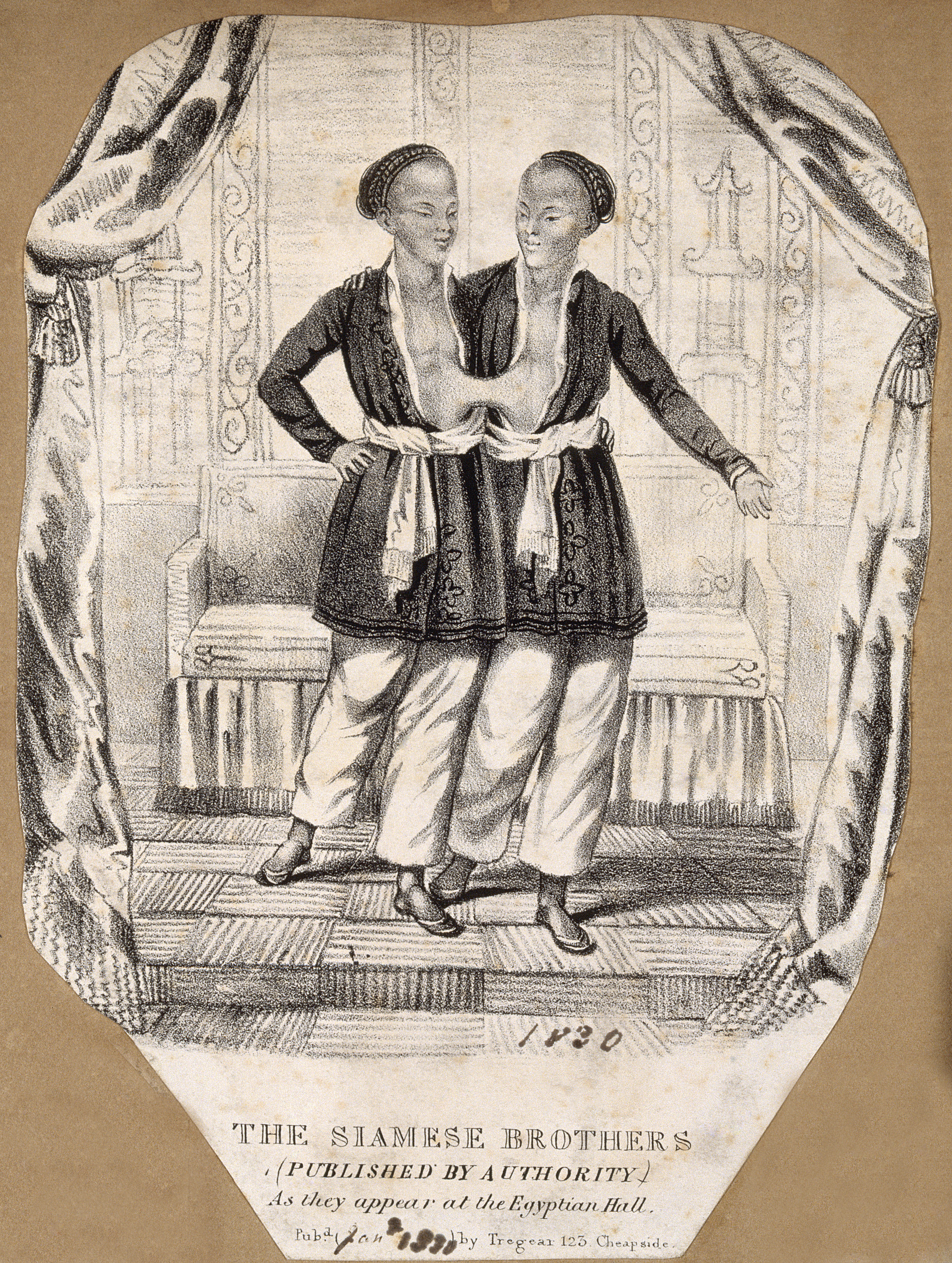 http://upload.wikimedia.org/wikipedia/commons/5/5c/Chang_and_Eng_the_Siamese_twins%2C_in_an_oriental_setting._Lit_Wellcome_V0007370.jpg