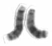 Miniatura para Cromosoma 13 (humano)