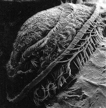 Micrographie électronique à balayage d'un cilié trichodinidé attaché aux branchies d'un mulet australien (Mugil cephalus)