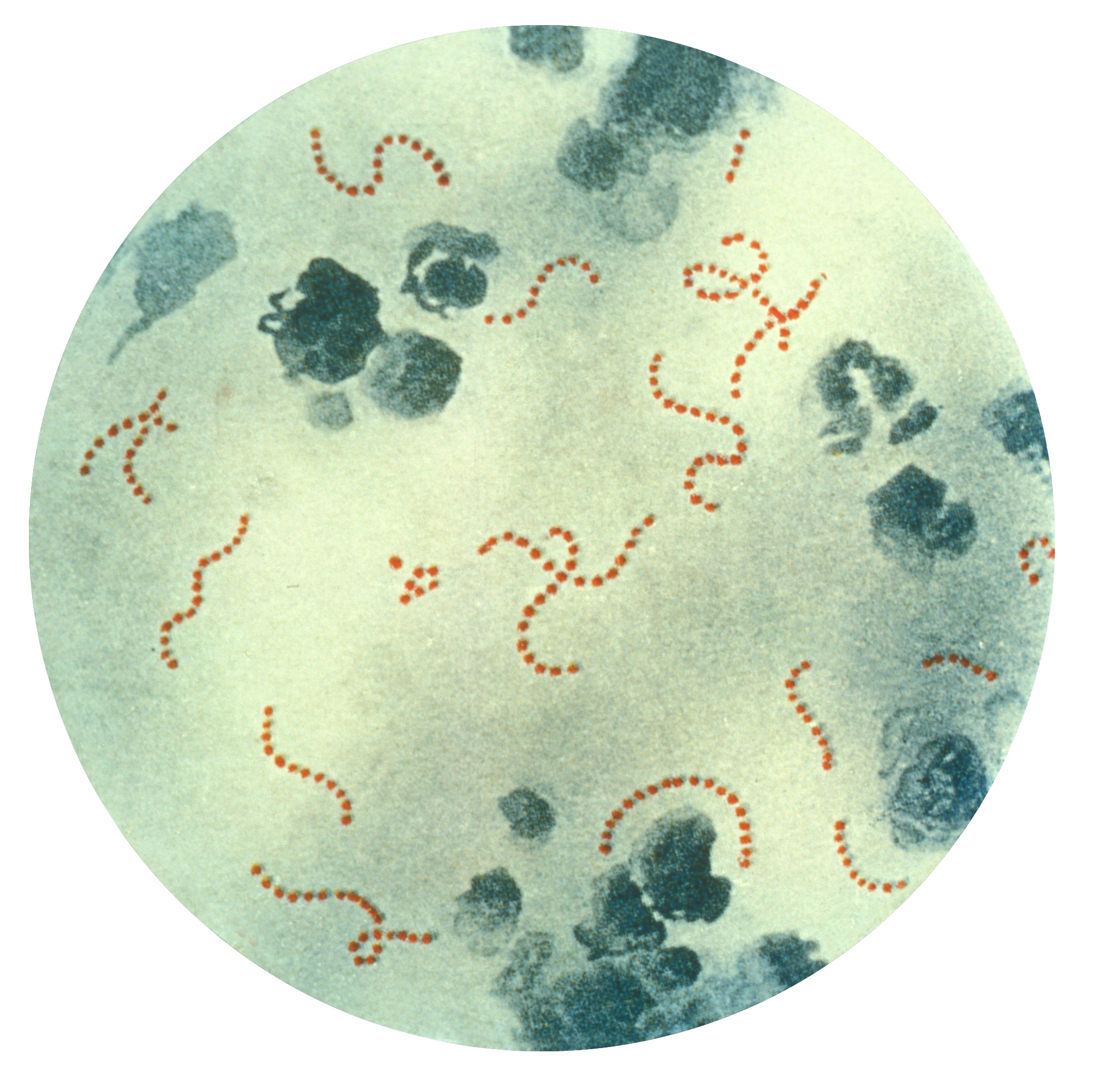 streptococcus  pyogenes