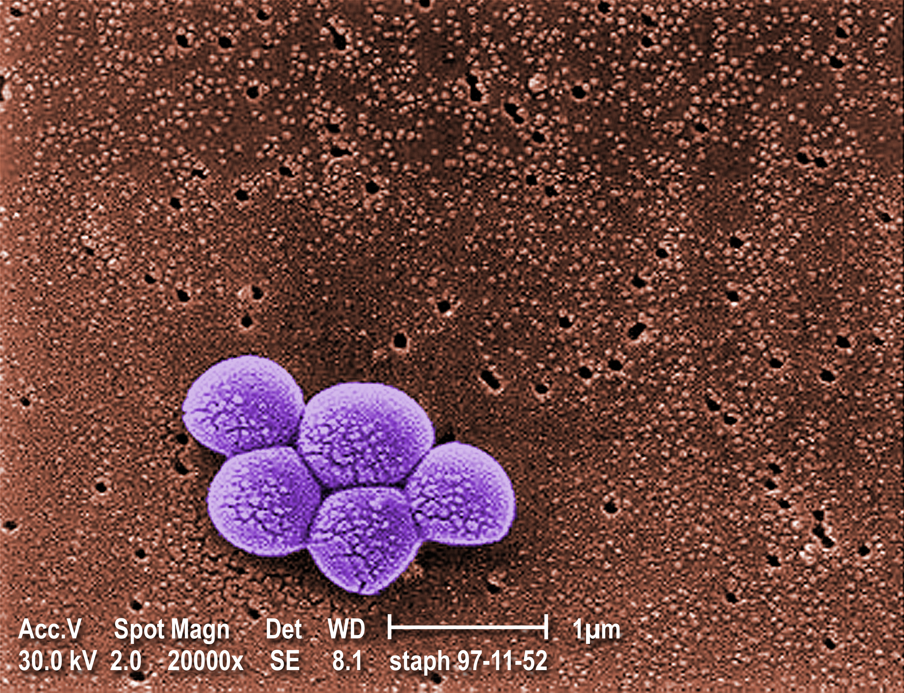 Mrsa Cells