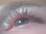 Animated image showing involuntary twitching in the upper eyelid of a young adult male.