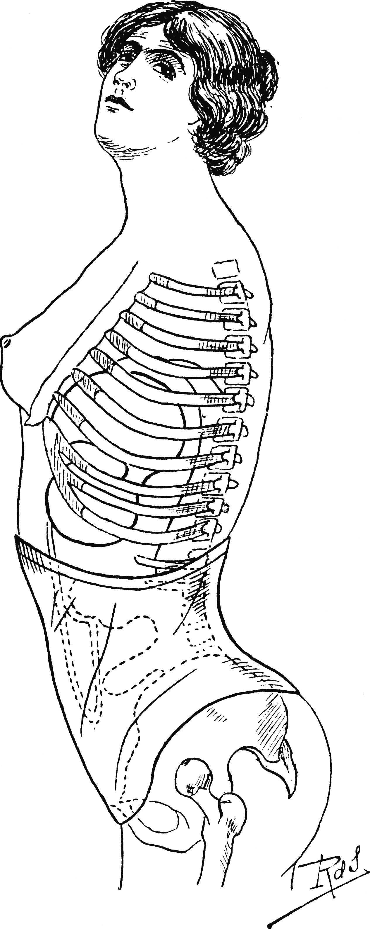 http://upload.wikimedia.org/wikipedia/commons/6/6a/Un_trone_feminin_vetu_d%27un_corset_abdominal.gif