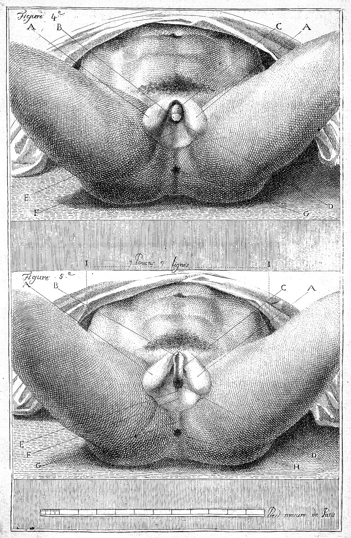 Гермафродиты Фото Их Половых Органов Настоящие Порно