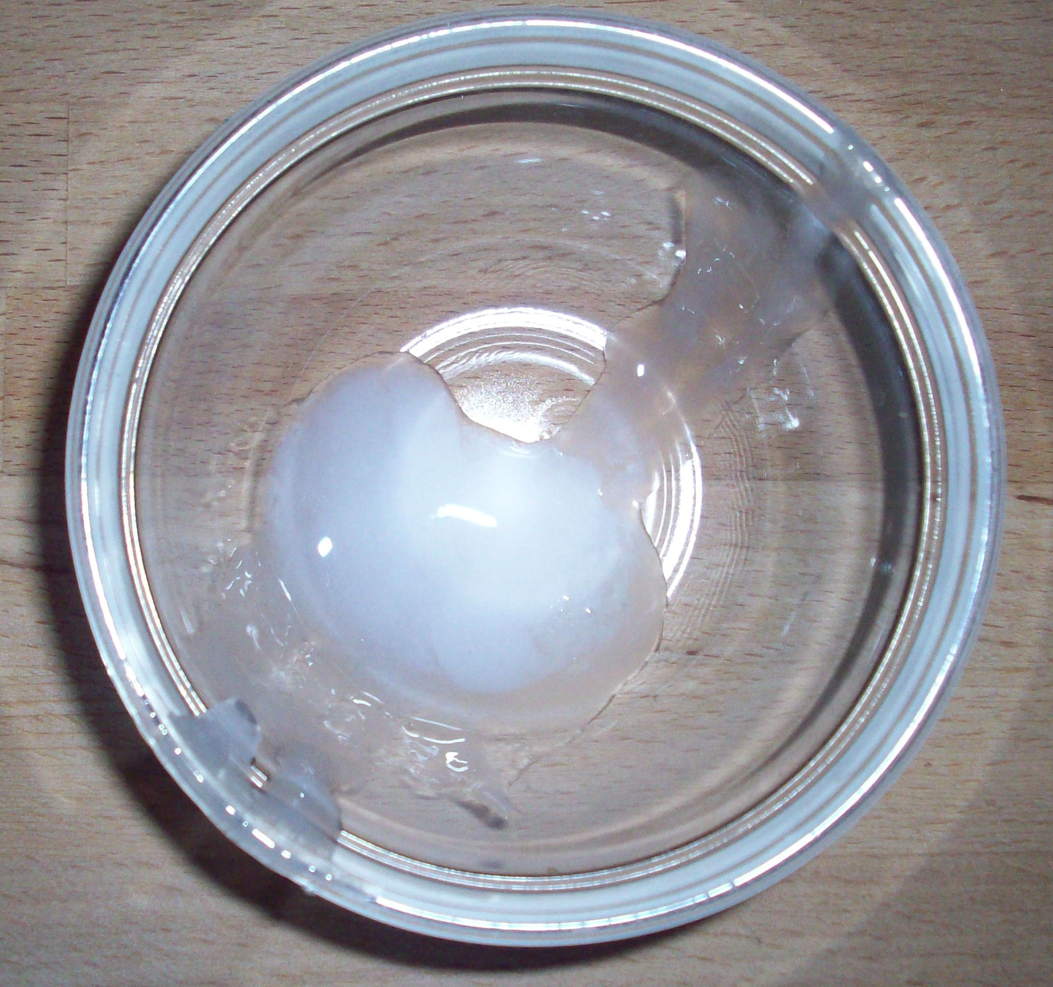 http://upload.wikimedia.org/wikipedia/commons/6/6d/Semen-sperma.jpg
