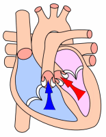 Image:Heart systole.png