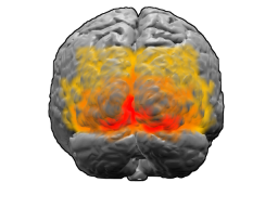 The extrastriate cortex (shown in orange and r...