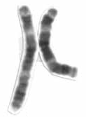 Человеческий мужской кариотп высокого разрешения - хромосома 3 cropped.png