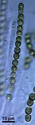 Ascus of Hypocrea virens with eight two-celled Ascospores Hypocrea virens.jpg