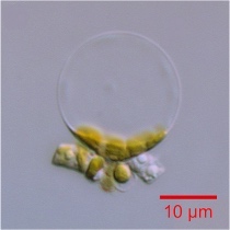 Thalassiosira pseudonana was the first eukaryotic marine phytoplankton to have its genome sequenced Thalassiosira pseudonana.jpg