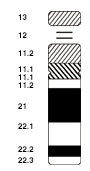 In Down syndrome, there are three copies of chromosome 21. Chromosome 21.png