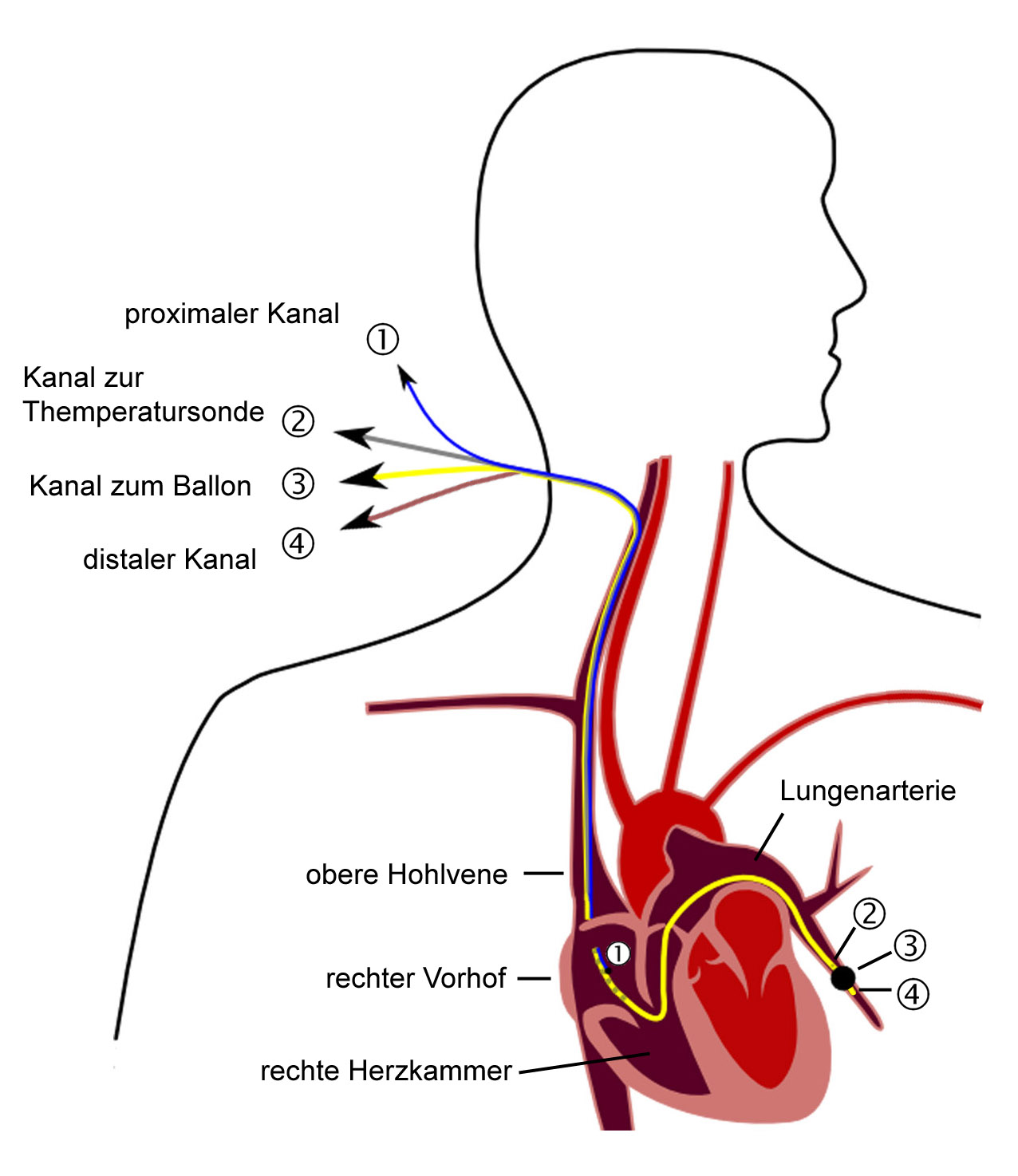 plumonary artery