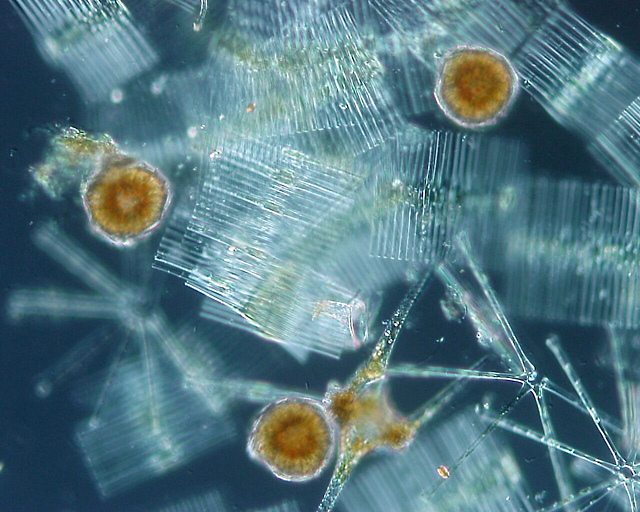 Link to original phytoplankton image from Wikipedia.