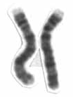 Човешки мъжки кариопет с висока разделителна способност - Chromosome 4 cropped.png