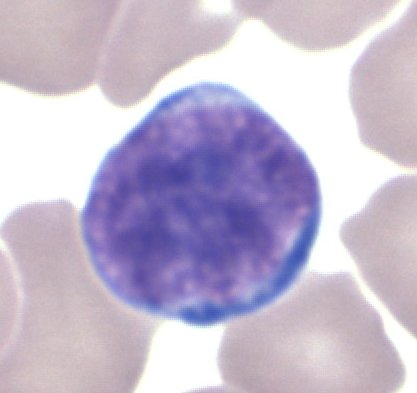 Imagen microscópica de un linfocito