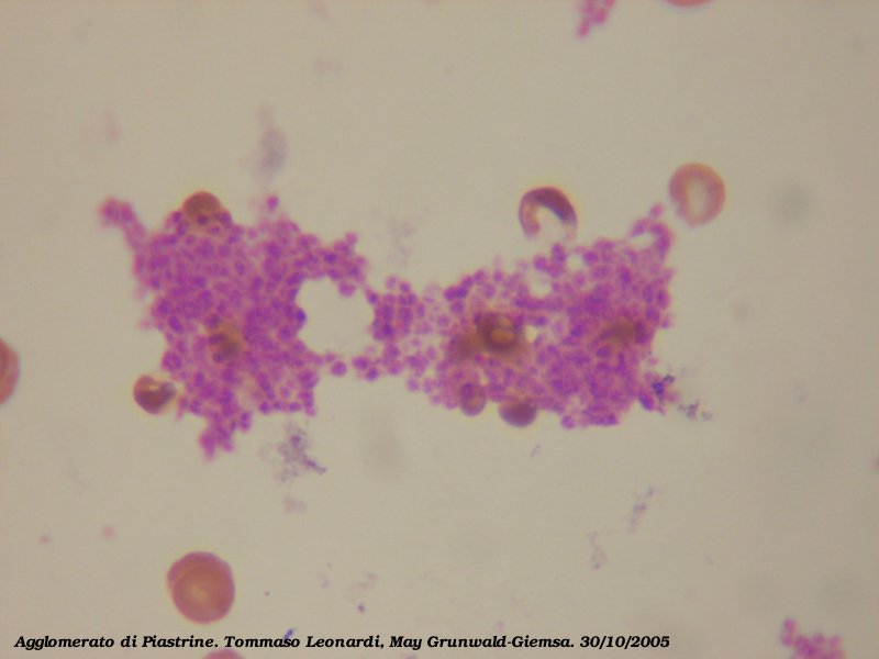 platelets blood cells. LEARN ABOUT RED BLOOD CELLS