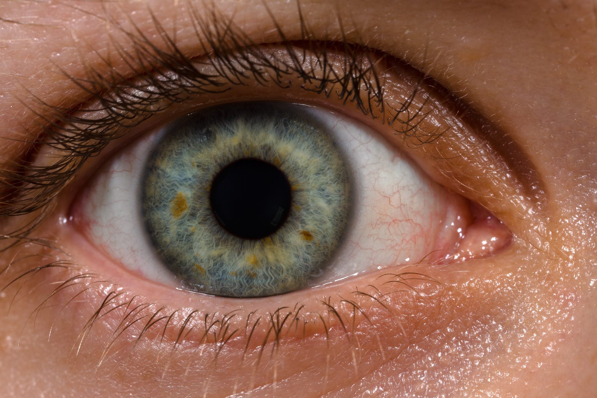 File:Human eye with blood vessels.jpg - Wikimedia Commons