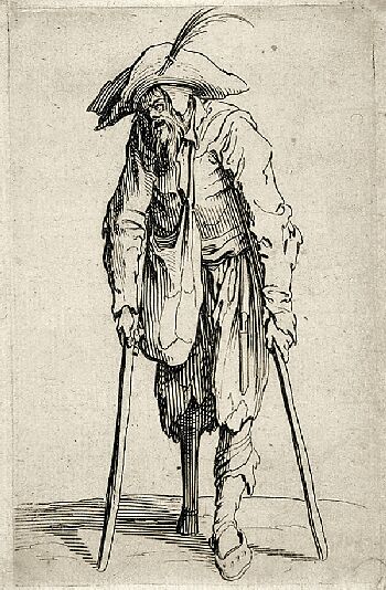 http://upload.wikimedia.org/wikipedia/commons/9/95/Jacques_Callot_Beggar.jpg