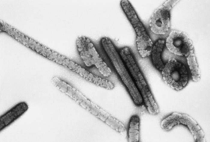 File:Marburg virus.jpg