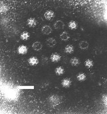 Eletromicrografia de um calicivírus do gênero Norovirus. Barra de escala = 50 ηm.