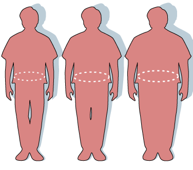 File:Obesity-waist circumference.PNG