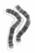 Человеческий мужской кариотп высокого разрешения - хромосома 2 cropped.png
