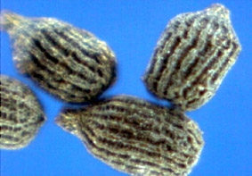 Drosera indica Trerummiga frökapslar (200 × förstoring) Innehåller stor mängd mycket små, svarta frön. 1 000 torra frön väger 15,5 mg