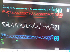 English: Monitor of vital signs in intensive c...