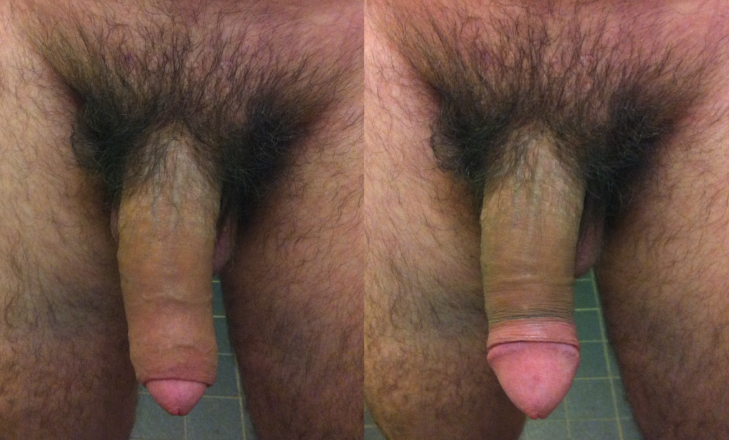 Uncircumcised cumshot