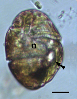 Lichtmikroskop-Aufnahme einer Zelle, durchscheinend braun, mit heller gefärbtem Zellkern in der Mitte und Ocelloid, bestehend aus einem hellen Bereich (Hyalosom, d. h. Linse) neben einem dunklen Bereich (Netzhautkörper).